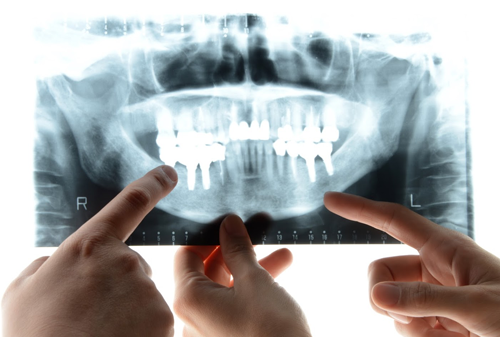 歯科用CT、シミュレーションソフトを使って安全に。大学病院とも連携。